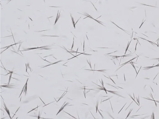 Microscopic uric acid crystals